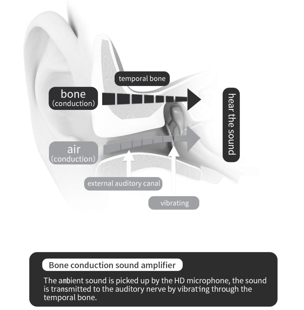 Best Bone Conduction Hearing Aids 2025: Revolutionary Solution for Profound Hearing Loss (80dB+) | bluedeer hearing aids 详情 04 e1741579077123 1003x1024