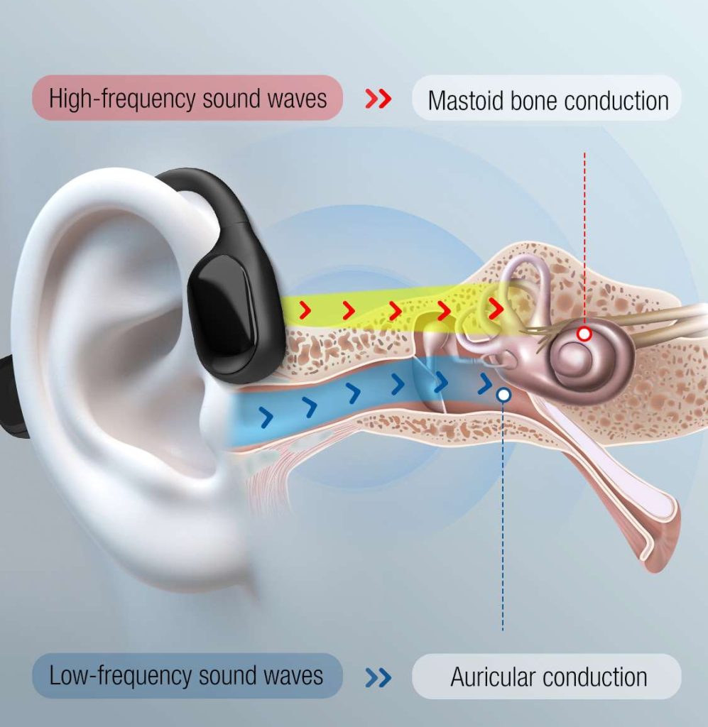 bone conduction hearing aid sending sound through cheekbone to inner ear diagram