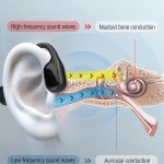 Bluedeer bone conduction hearing aid working principle diagram, dual mastoid bone conduction and auricular conduction, high‑fidelity clear voice sound capture for hearing loss assistance